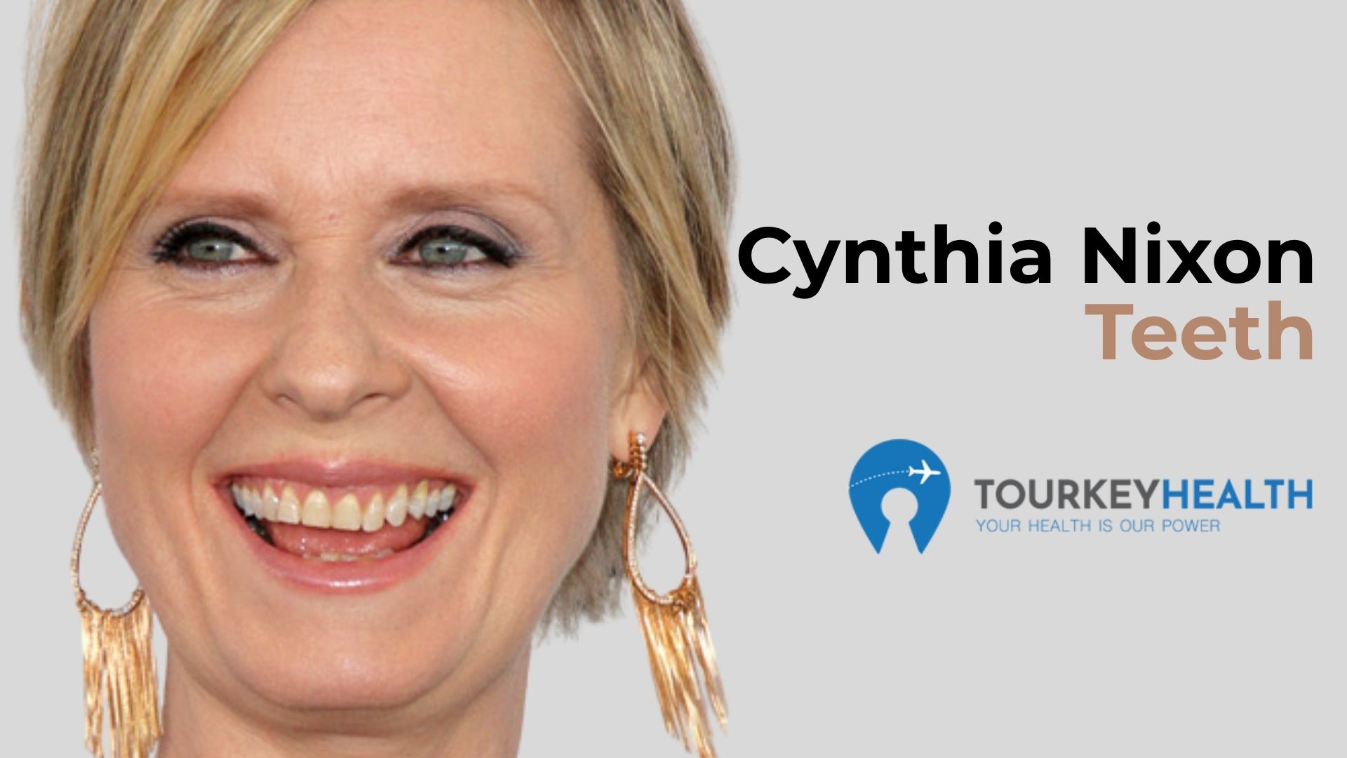 cynthia-nixon-teeth 