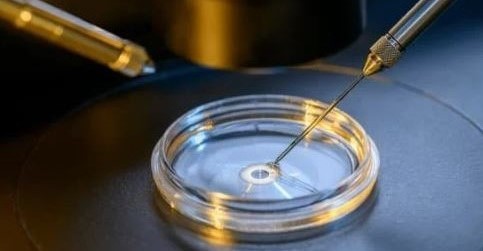 what-is-in-vitro-fertilization-ivf-turkey