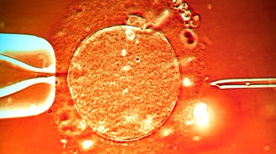 What is IVF and how is it done? in Turkey 