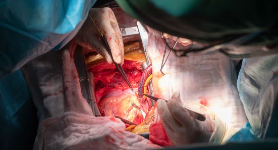 gastric bypass operation in Turkey